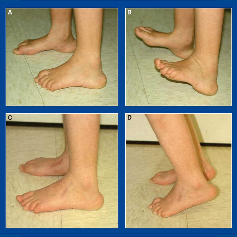 Treatment & Surgery of Congenital & Acquired Deformities